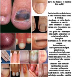 Corso Malattie delle unghie
